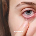 Glaucoma Surgeon in Madurai