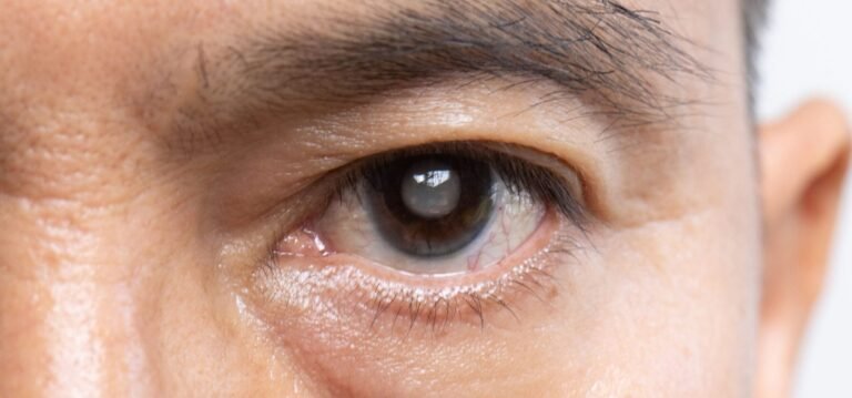 Best Glaucoma Surgeon in Madurai